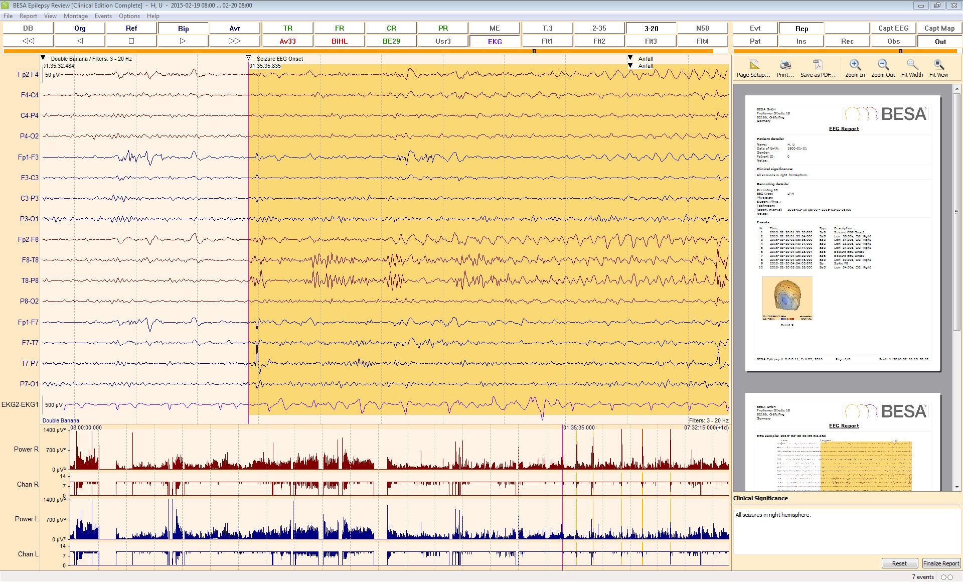 BESA_Epilepsy_2_0_Seizure_Review_Home besa epilepsy
