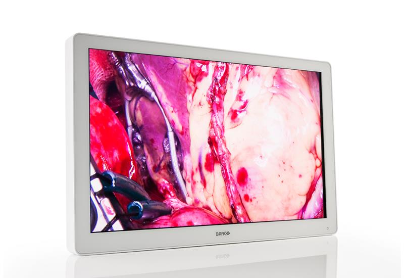 MDSC-2232 3-4 right endoscopy jpg