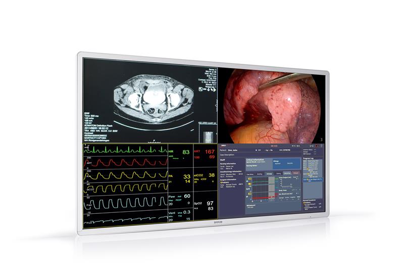 MDSC-8255 3-4 left onwhite jpg